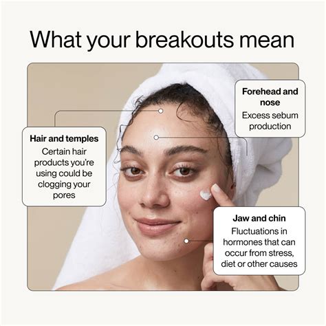 How to Treat Forehead Acne (and Prevent It From Coming Back) | Software