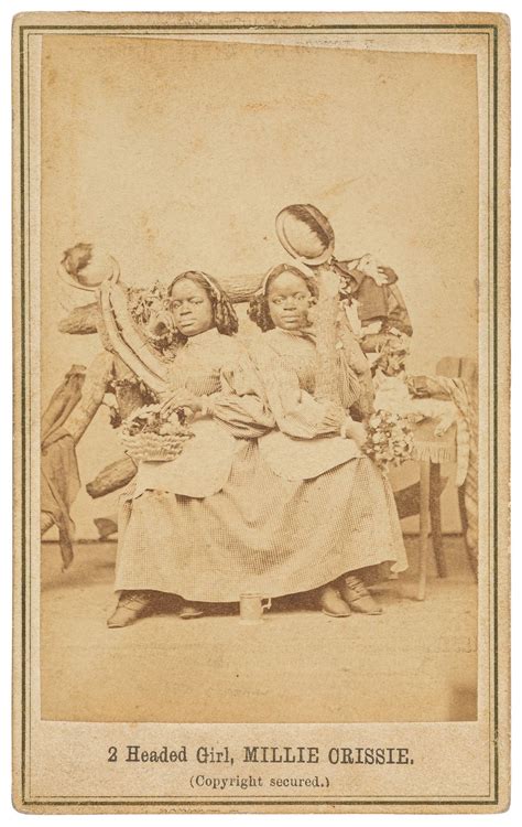 [Photograph of Conjoined Twins]: 2 Headed Girl, Millie Crissie by ...