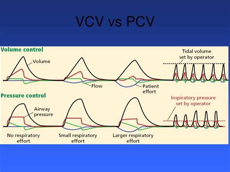 Image result for APRV Mode Explained