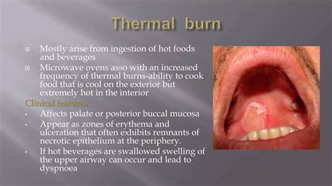 Non keratotic white lesions of the oral cavity | PPTX