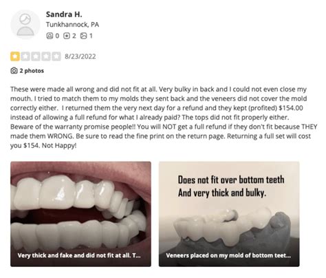 Pop On Veneers Review: Are They Really Worth It?