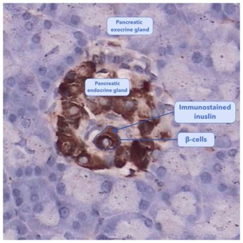 Image result for Beta Cell Structure