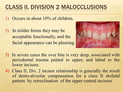 Orthodontic class 2 div 2 | PPTX