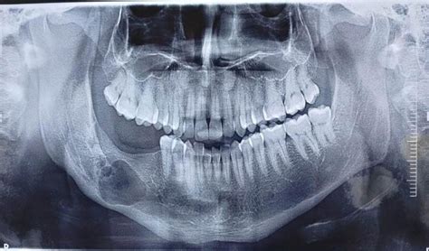 saraswati dental college