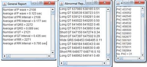 Image result for Code Sinus Java