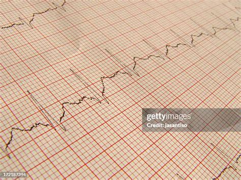 Image result for ECG Graph Paper