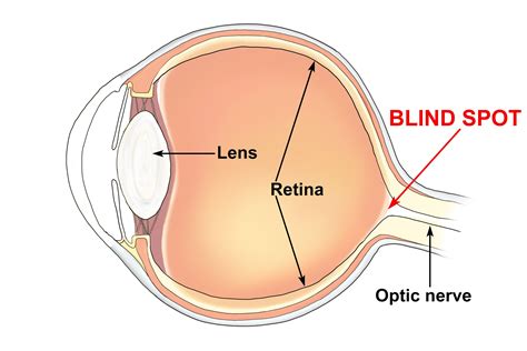 Blind Spot In Eye