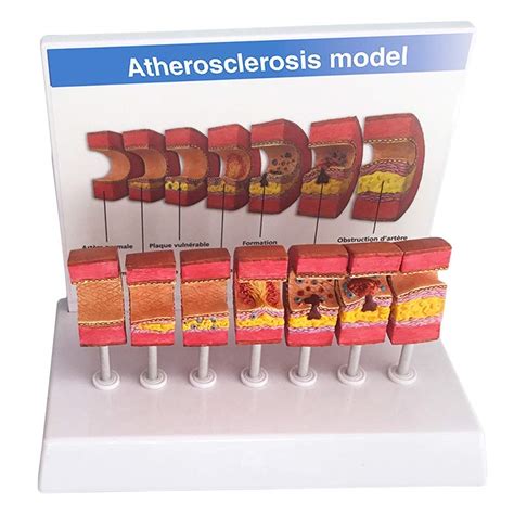 Buy Educational Model Artery Anatomical Model Anatomical Vessel ...