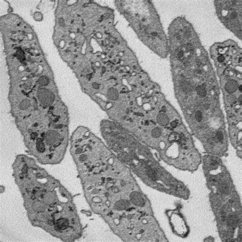 Image result for Cell Image Object Detection Python Code