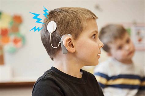 Understanding the effects of static electricity on cochlear implants