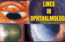 Image result for Pinhole Visual Acuity Test