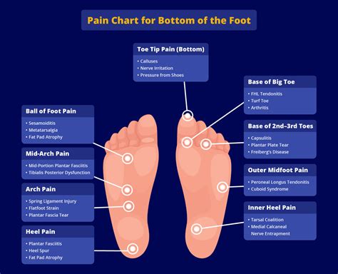 Foot Pain Chart: What Your Pain Location Might Mean