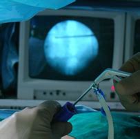 Image result for Disc FX Procedure