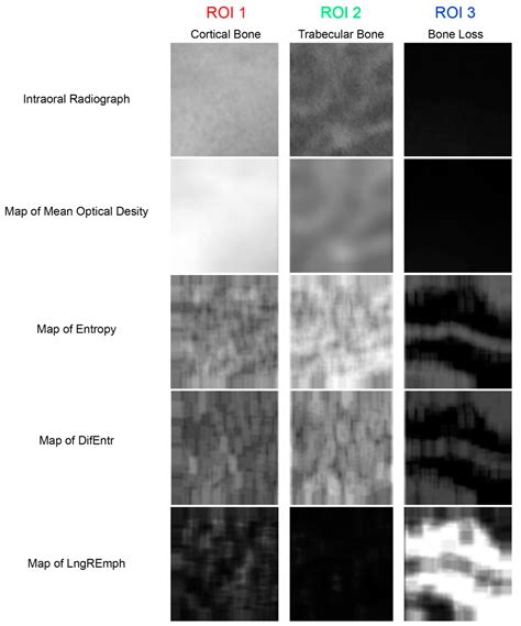 Measures of Corticalization