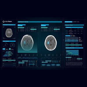 Image result for Alert Software