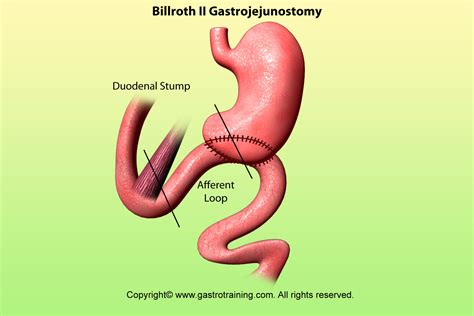 Gastroenterology Education and CPD for trainees and specialists ...