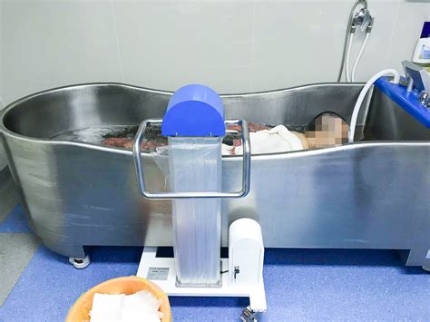 浸浴治疗机（弧形）临床使用效果展示_江苏爱华泰克医疗器械有限公司
