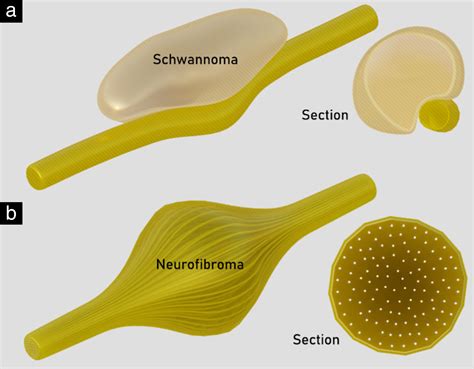 Imaging in gynecological disease (26): clinical and ultrasound characteristics of benign ...
