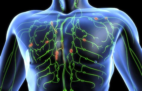 Los síntomas del linfoma y sus diversas causas - Cultura y ocio
