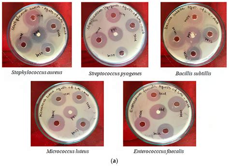 Green Synthesised Silver Nanoparticles Using Anoectochilus elatus Leaf ...
