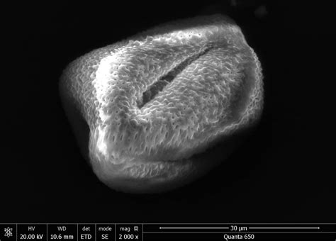 Image result for Flower Pollen Under Microscope