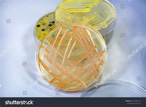 What Is A Mixed Culture In Microbiology at Georgia Levvy blog