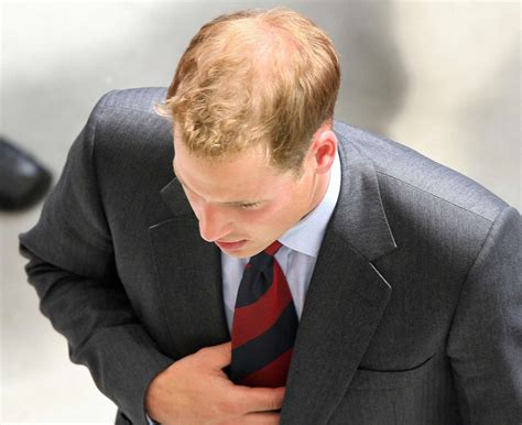 Prince William's Hair Through the Years