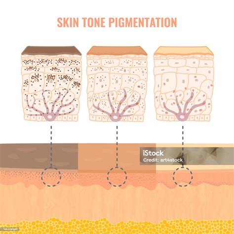 Ilustración de Diagrama Infográfico De Diversidad De Pigmentación Del ...