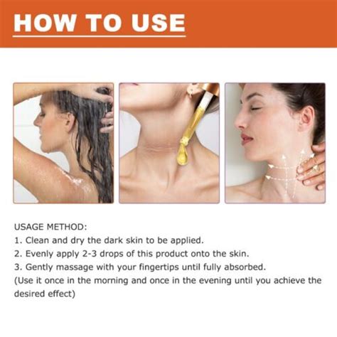 Acanthosis Nigricans Therapy Oil Knee Body Bleaching | Ubuy India