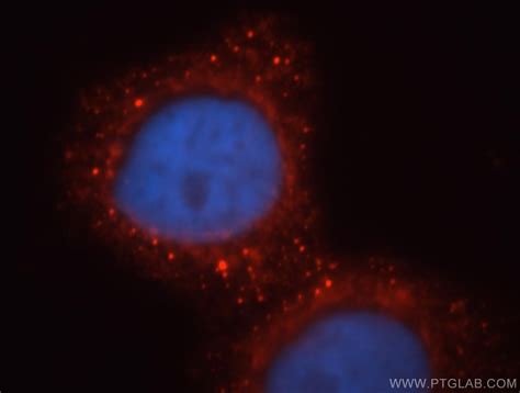 MPPED2 antibody (13270-1-AP) | Proteintech