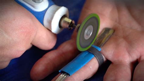 Image result for Ring Removal String Technique