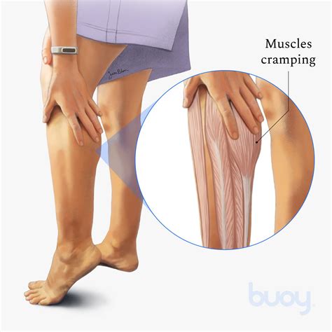 How Stop Charlie Horse Cramps Waking Up With Sore Calves? What To Know