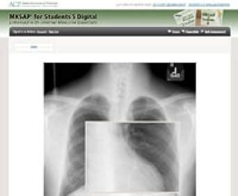 Buy MKSAP for Students 5 Digital: Enhanced with Internal Medicine ...