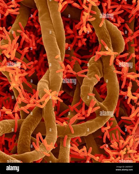 Coloured scanning electron micrograph (SEM) of Soil bacterium and soil ...