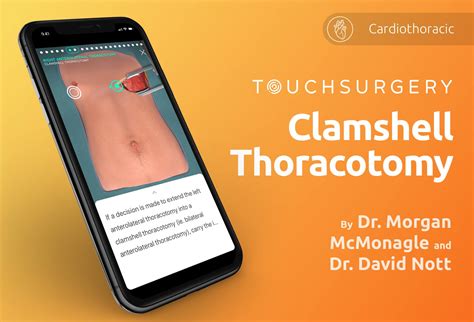 Image result for Clamshell Thoracotomy