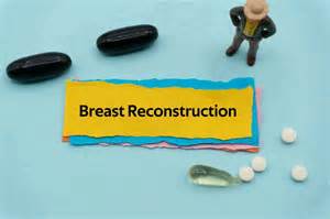 Everything You Need to Know About Breast Reconstruction