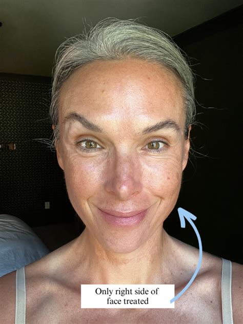 NuFace Neck Tutorial 的图像结果