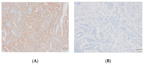 Analysis of the Expression of LSF Transcription Factor in the ...