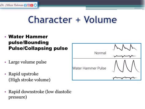 Heart rate calculation by Arterial Pulses.pptx