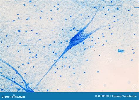 Motor Neuron Under the Microscope. Stock Image - Image of histological ...