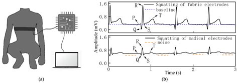 Design, Characterization, and Performance of Woven Fabric Electrodes ...