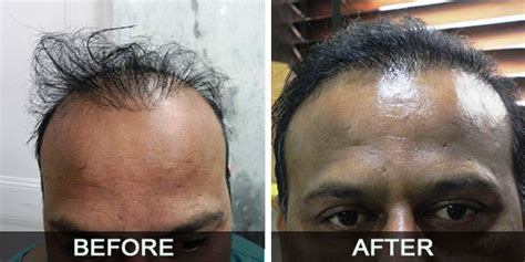 Aggarwal Hospital-Our Treatment History