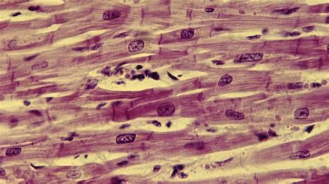 Image result for Cardiac Muscle Tissue Cells