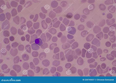 Nucleated Red Blood Cells NRC In Blood Smear Stock Photo ...