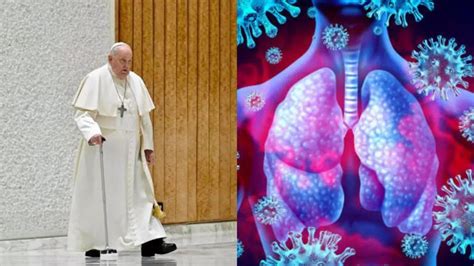 What Is the Polymicrobial Respiratory Tract Infection, Pope Francis Is ...