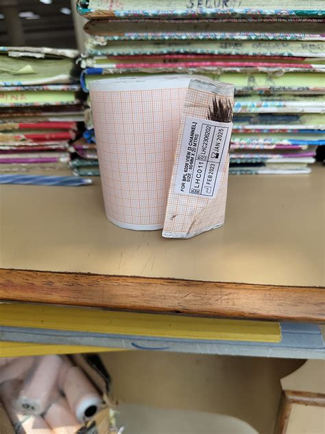 SKYTRENDS Sky Trends Bpl Ecg Graph Paper Roll Width 80 Mm&Length 20 ...