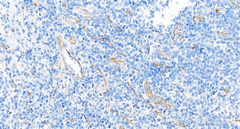 VEGFR2/CD309 antibody (83049-4-RR) | Proteintech