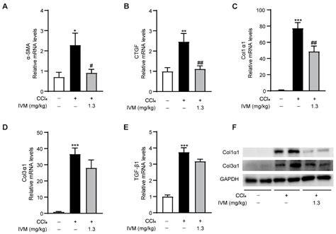 Ivermectin Attenuates CCl4-Induced Liver Fibrosis in Mice by ...