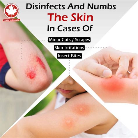 Buy DR. NUMB Topical Anesthetic Foaming Soap - 4% Lidocaine Numbing ...