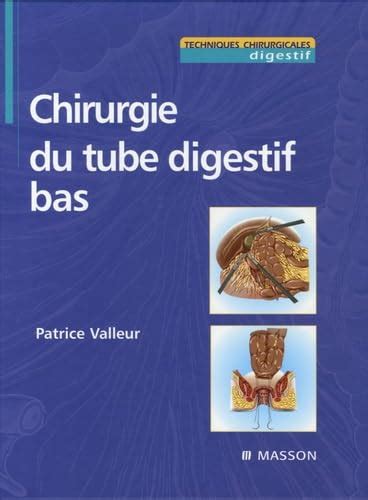 Amazon.in: Buy Chirurgie du tube digestif bas Book Online at Low Prices ...